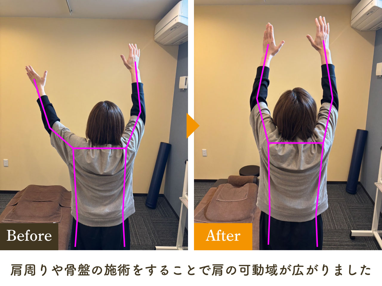 施術後の変化 Before After