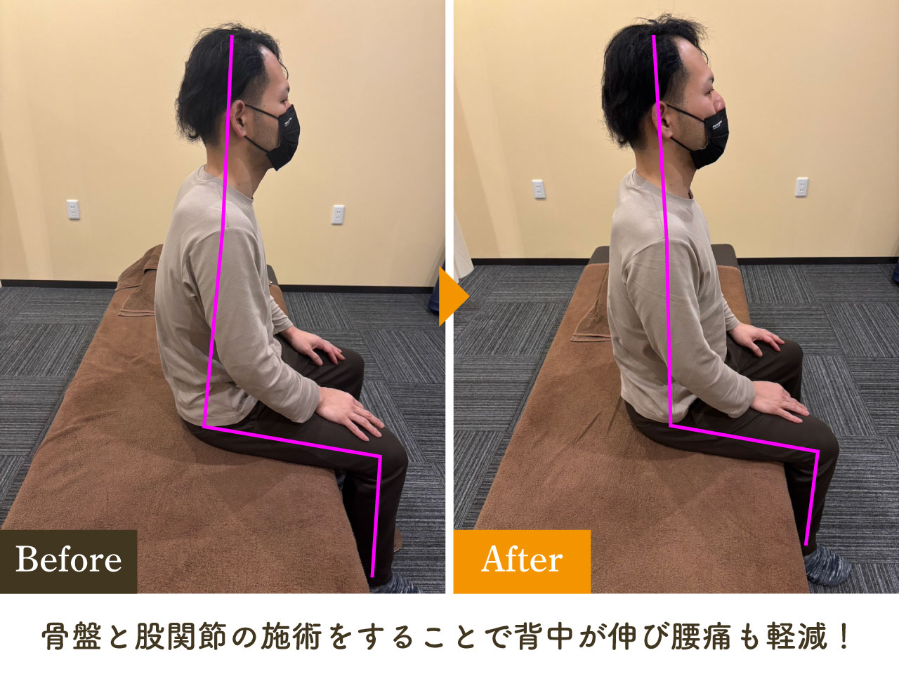 施術後の変化 Before After